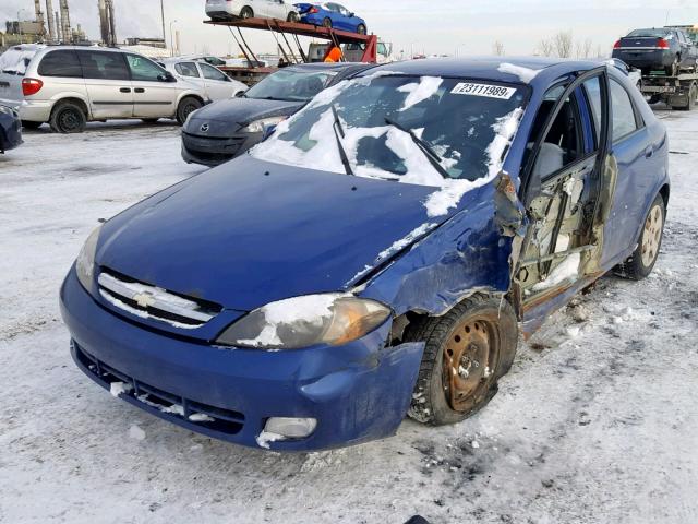 KL1JK69Z85K077236 - 2005 CHEVROLET OPTRA 5 LS BLUE photo 2