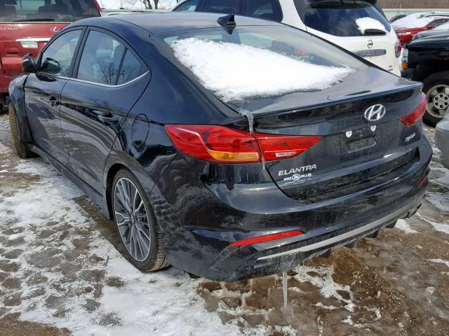 KMHD04LB1JU636034 - 2018 HYUNDAI ELANTRA SP BLACK photo 3