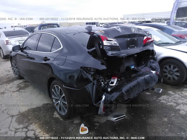 19UUB2F39JA000150 - 2018 ACURA TLX BLACK photo 3